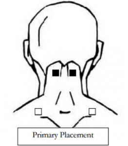 Complete Guide to your TENS Machine Pad Placements | TENS Machines for Sale