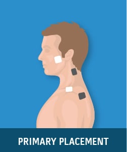 How to Use a TENS Unit With Neck Pain. Correct Pad Placement 