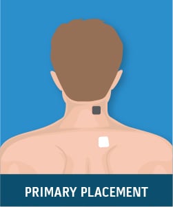 29. HOW TO USE A TENS UNIT WITH NECK PAIN. CORRECT PAD PLACEMENT