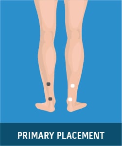 Complete Guide to your TENS Machine Pad Placements - TENS Machines for Sale