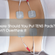 Where-Should-You-Put-TENS-Pads-Don't-Overthink-It